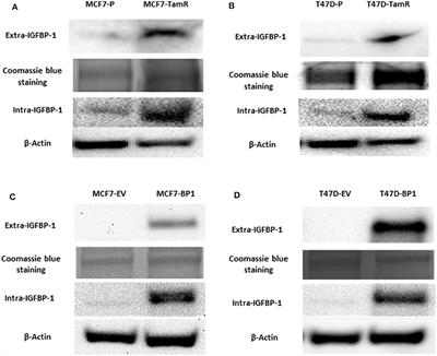 IGFBP-1 Expression Promotes Tamoxifen Resistance in Breast Cancer Cells via Erk Pathway Activation